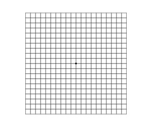 Amsler Grid